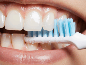 Oral Hygiene with Elastics